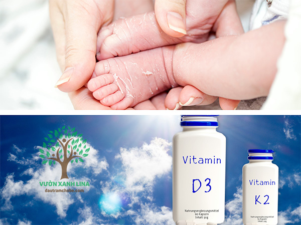 vitamin d cho trẻ sơ sinh mùa đông